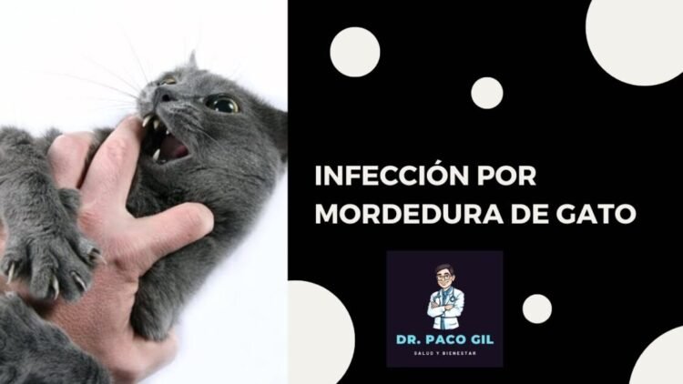 Infección por mordedura de gato: ¿Más peligroso de lo esperado?